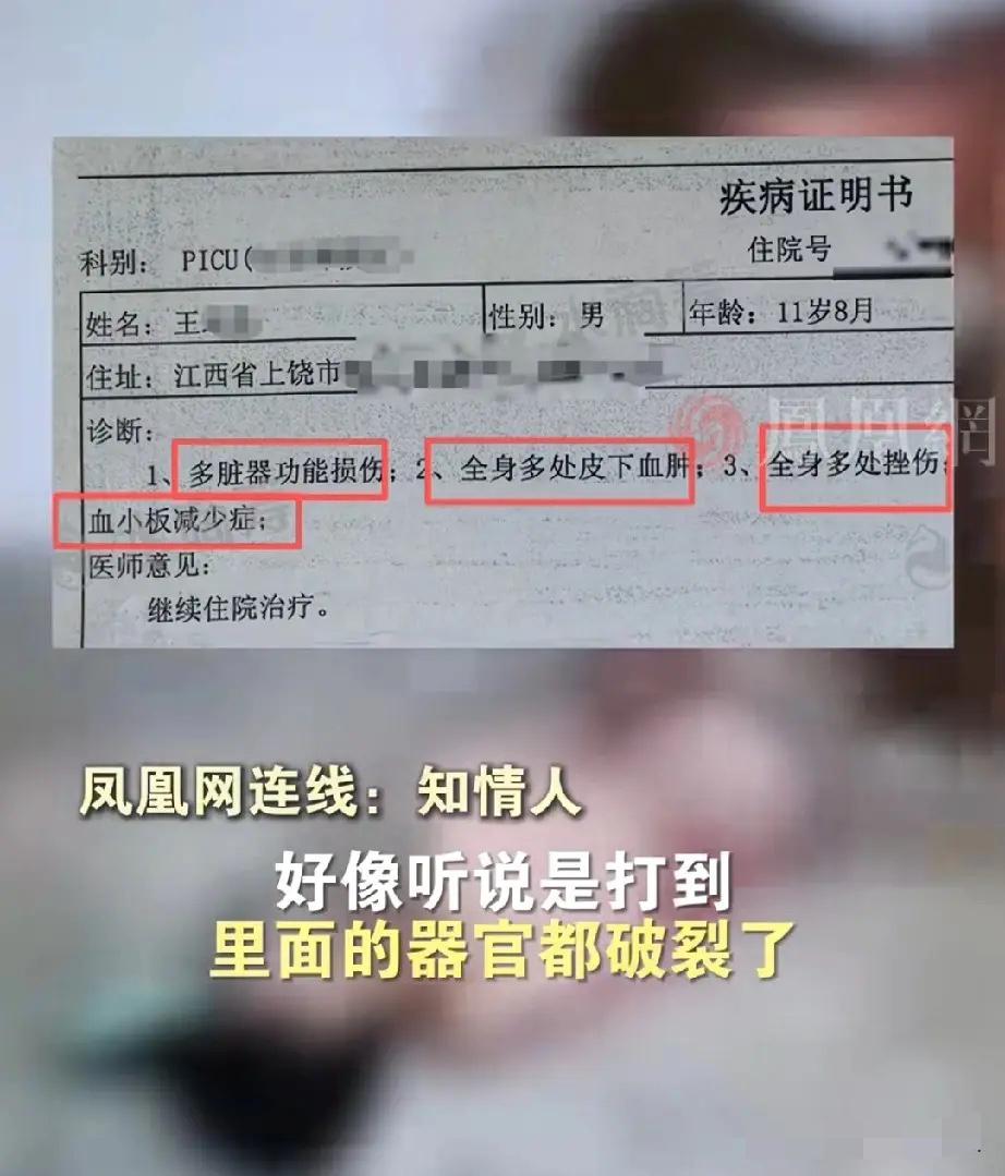 江西上饶那事看得人心脏揪着疼!11岁的孩子被五六个同学霸凌,连续打了6小时,