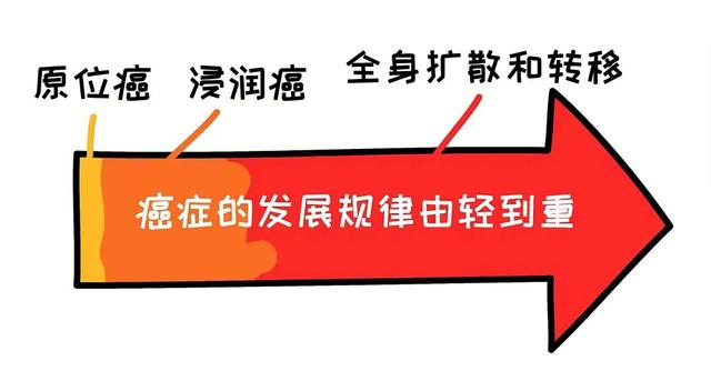 癌症“浸润”就是扩散了吗? 得了浸润癌还需要化疗吗? 一文搞清楚