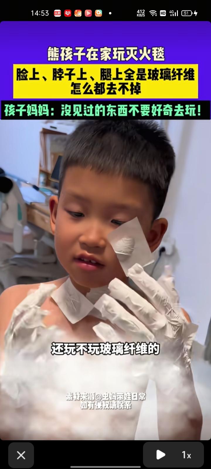 3月27日，广东深圳。熊孩子在家玩灭火毯，脸上、脖子上、手上沾满玻璃纤维，怎么都