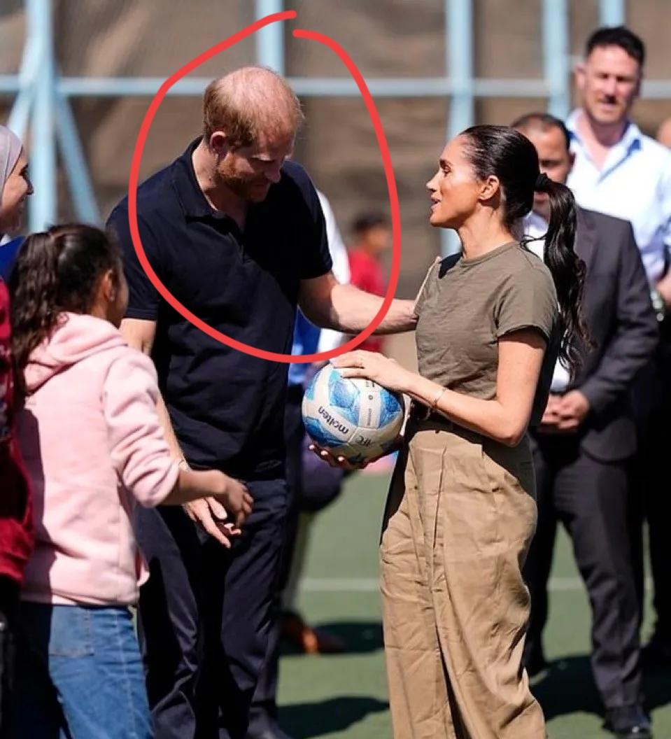 梅根的造型，哈里都看不下去了！为了复刻凯特，梅根那是无所不用其极！这不去约旦