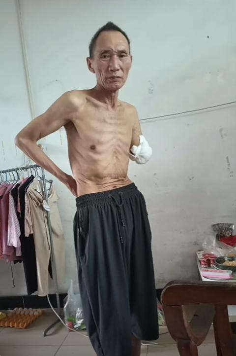 贵州双女家庭父亲，工厂去年干活时发生意外，左手惨遭截肢，鉴定为三级残疾，无良老板