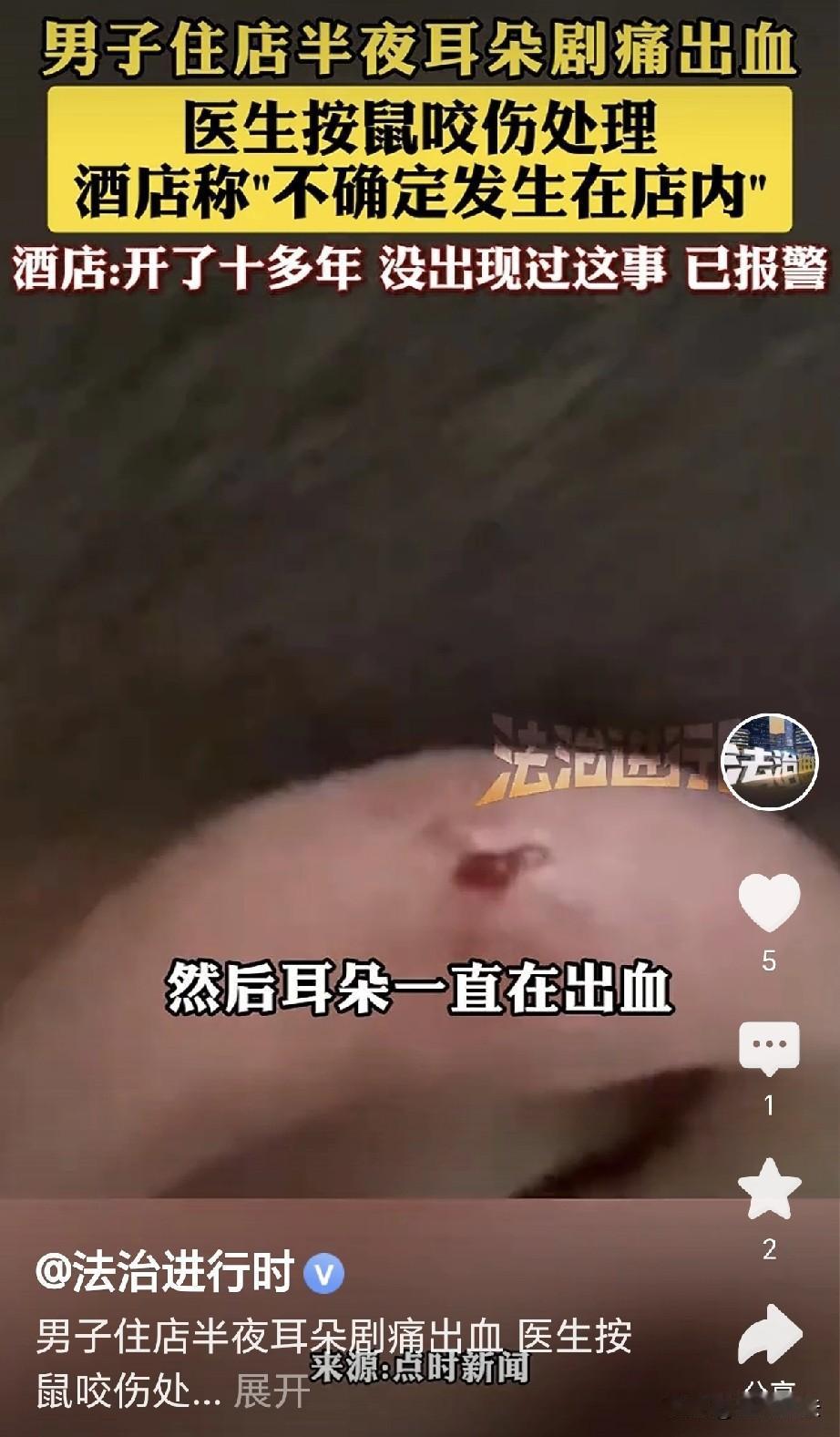 上海，一男子和朋友入住酒店，正睡的香甜，突然感觉右耳朵持续疼痛，他用手一摸，吓一