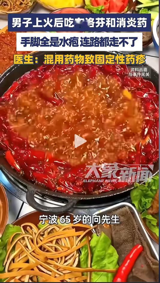 “悲剧还是发生了！”近日，浙江宁波，一男子因为连续吃火锅后开始牙疼，就吃了点布洛