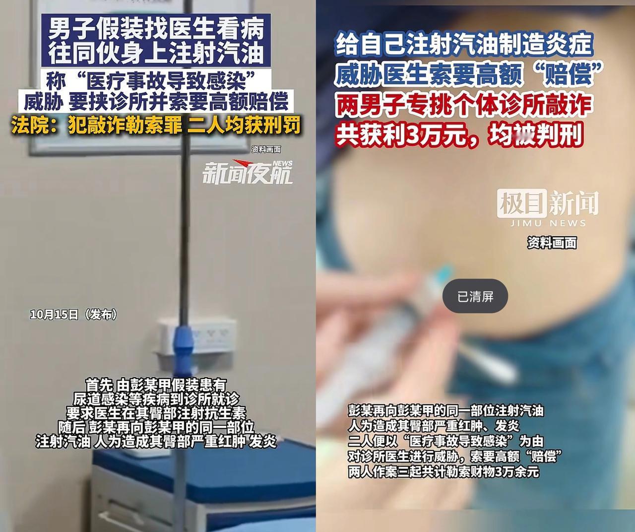 太可怕了！为了讹钱，竟然往自己屁股上注射汽油，这俩骗子简直疯魔了！湖北