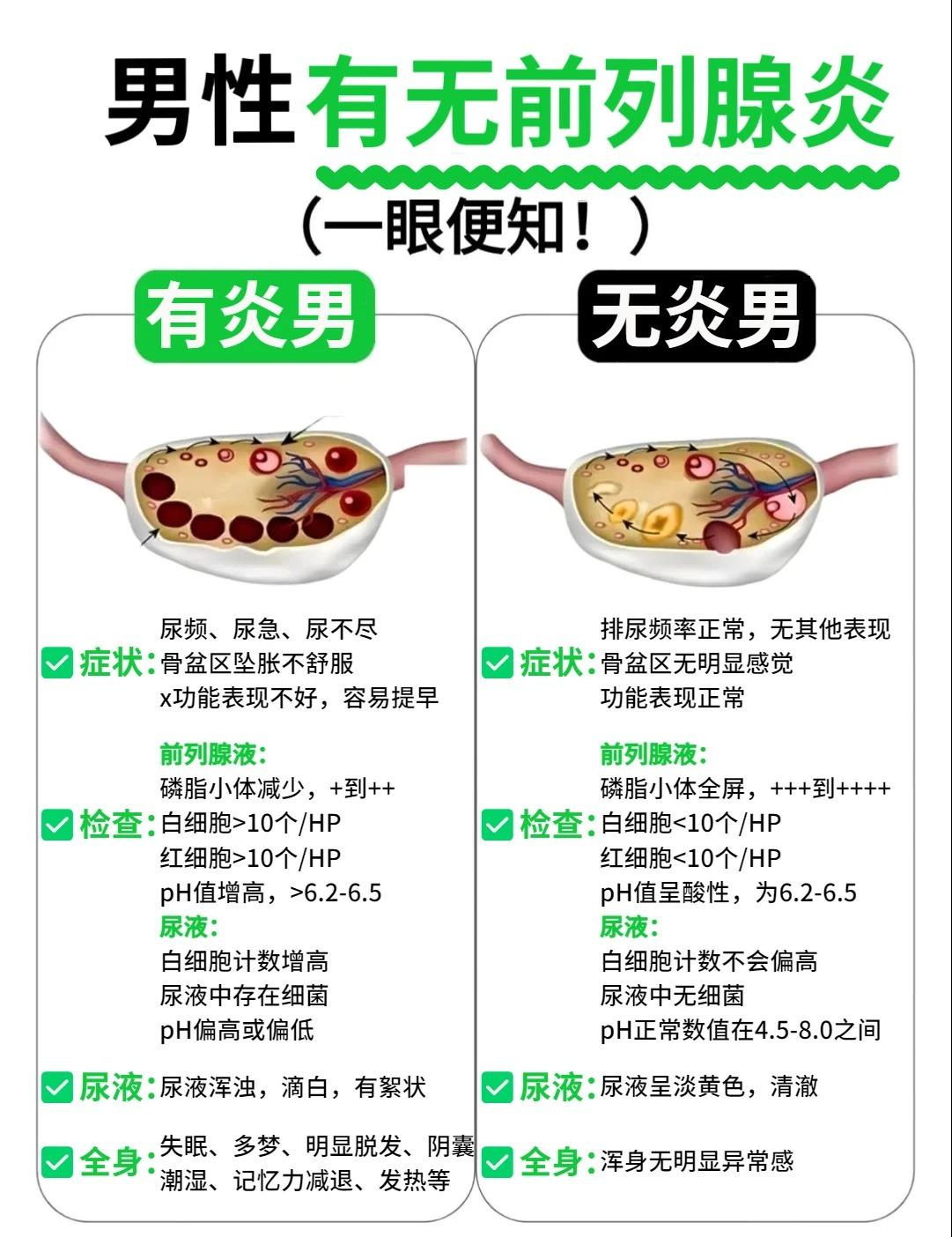 是不是前列腺炎？一眼便知