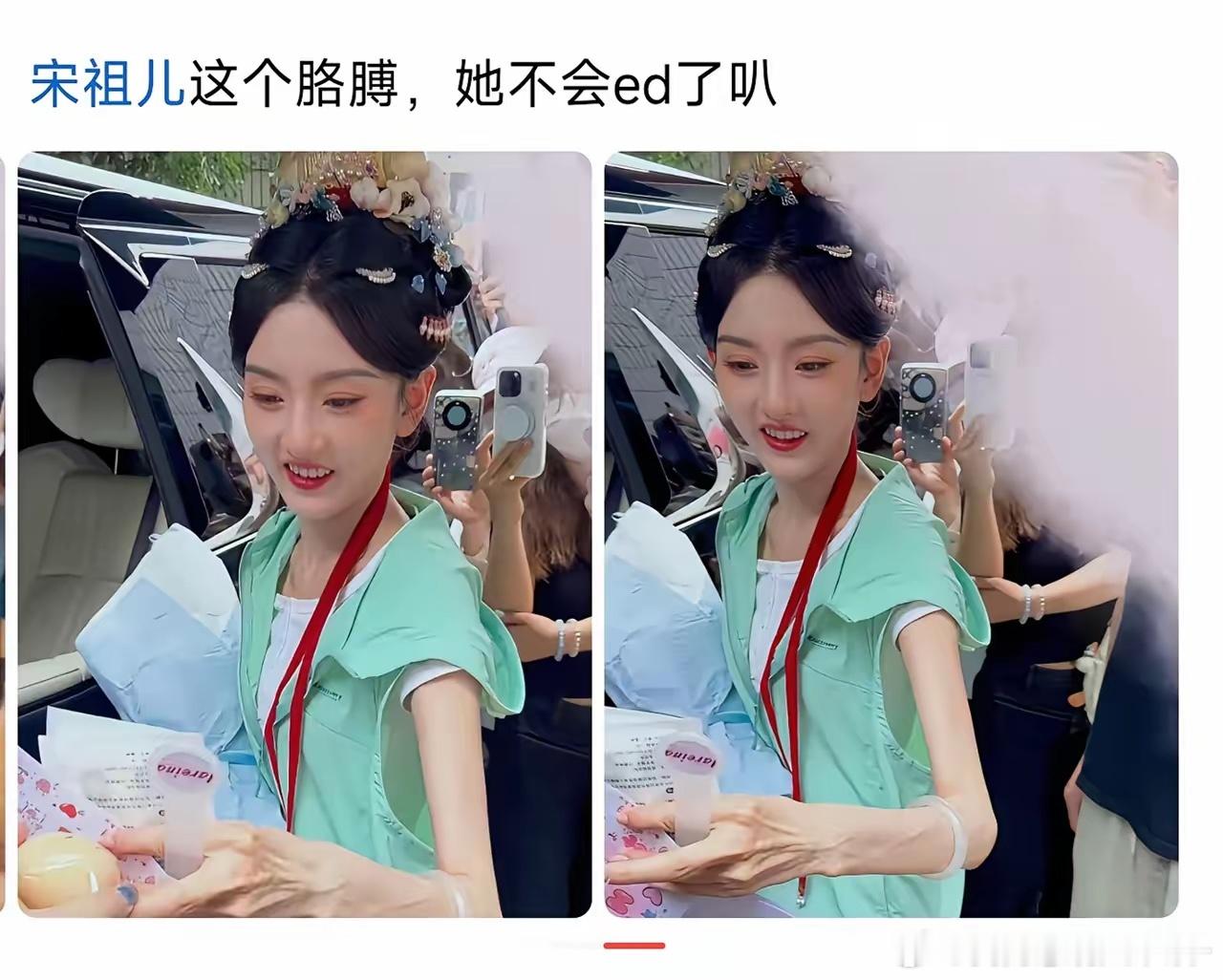 宋祖儿镯子都滑到大臂了，她真不饿吗？