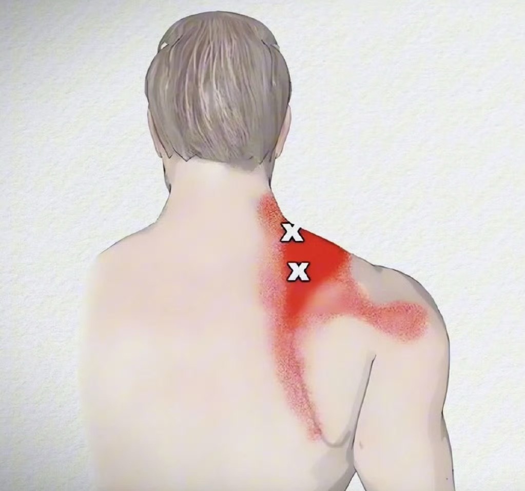 前两天讲到久坐腰痛与坐姿，不少朋友反馈，自己坐久了还会肩胛骨缝疼那今天就来接着总