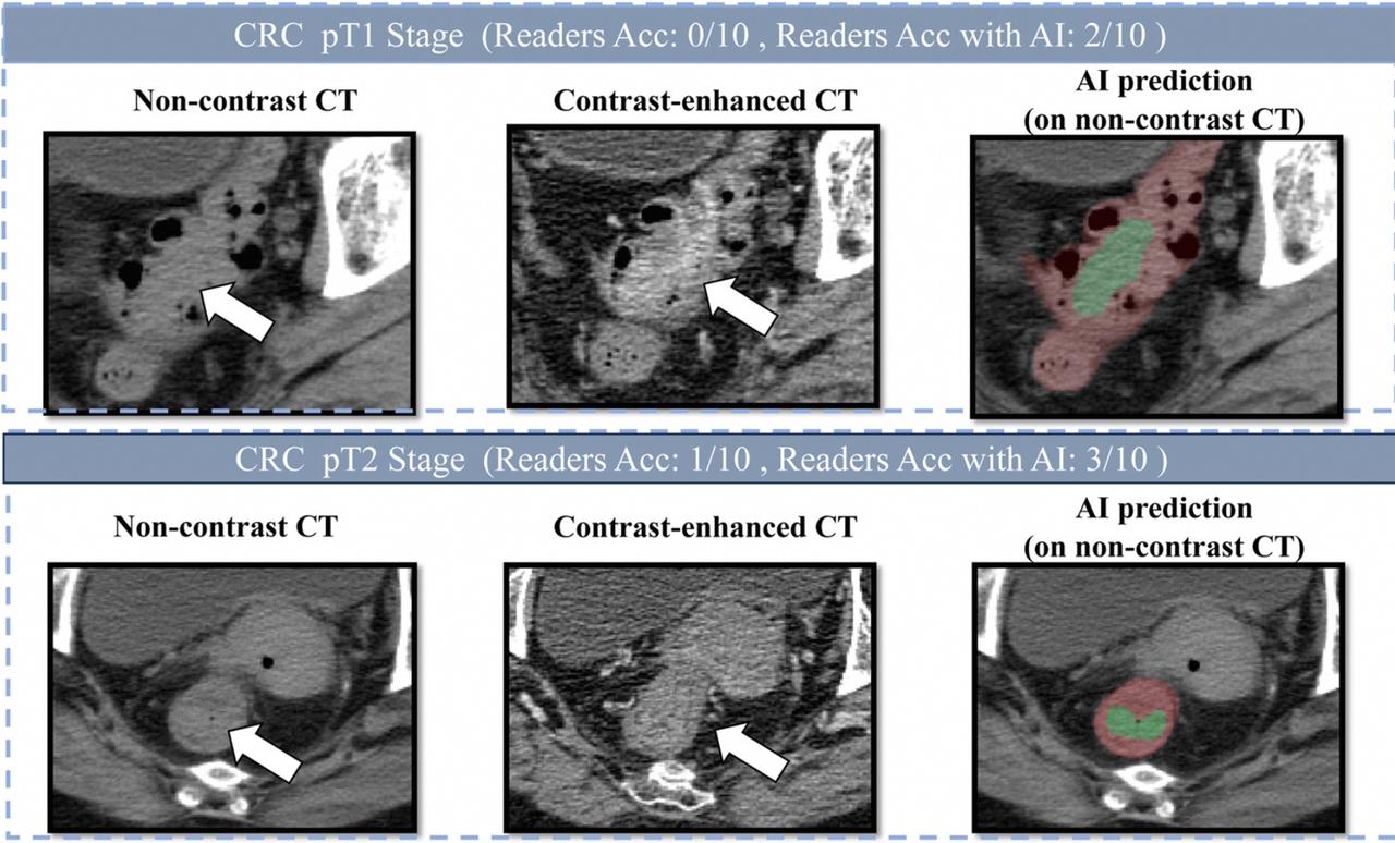 进入2026年，国内有一个反常现象愈渐明显了，什么情况？曾经中国人出国看病，