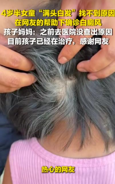 网友的含金量还在上升！近日，贵州一位宝妈发帖求助，自己4岁女儿出现了大量白发，