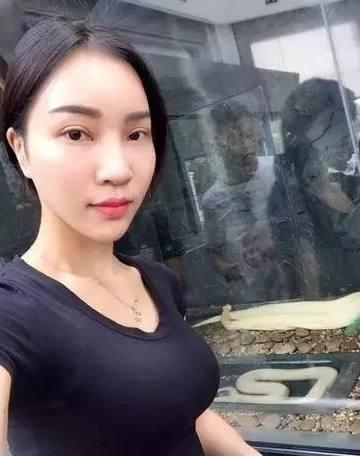 隆鼻修复已经3个月了, 来记录下鼻型的恢复
