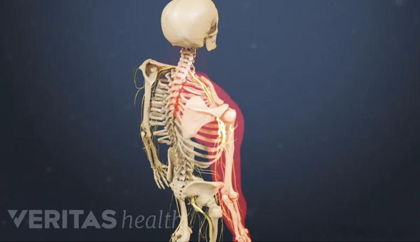 颈椎病脖子疼，僵硬，手臂手指发麻？今天给大家讲讲——颈椎病的不同类型和对应症状