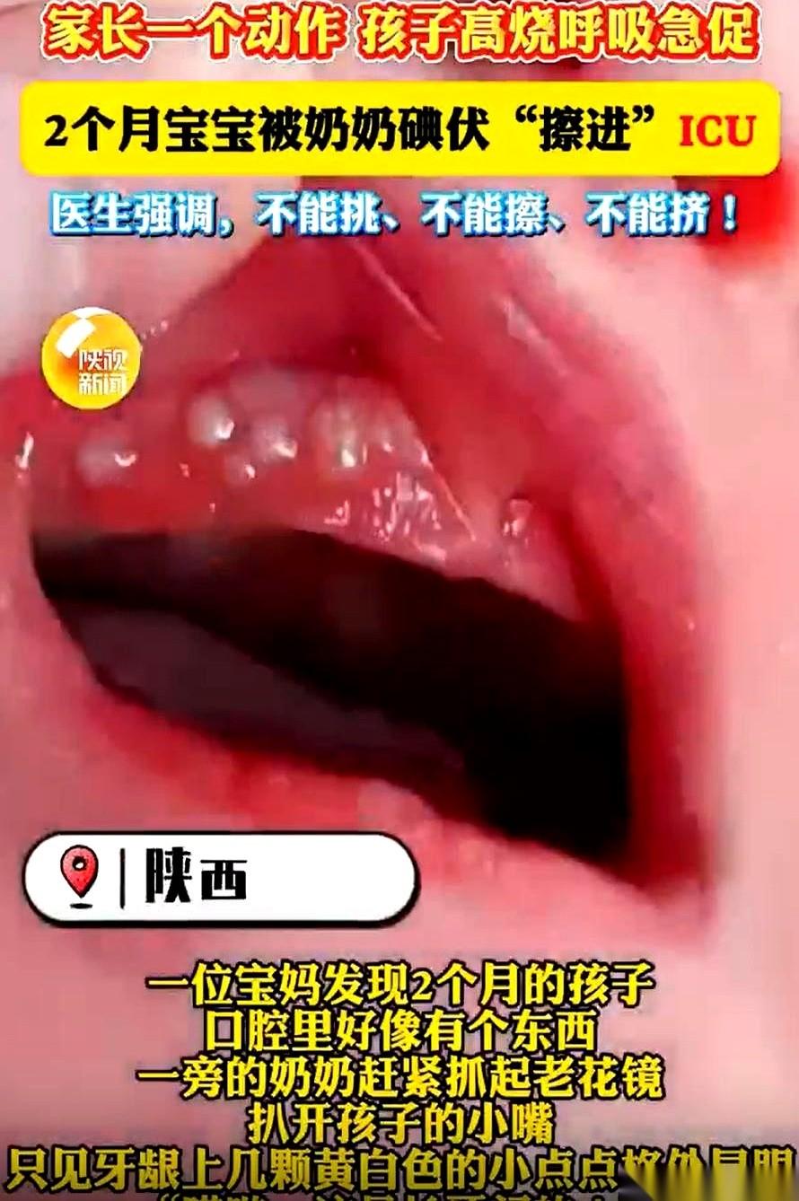 就因为奶奶往孙子嘴里抹了点碘伏，俩月大的孩子直接干进了ICU。我跟你说，这事儿