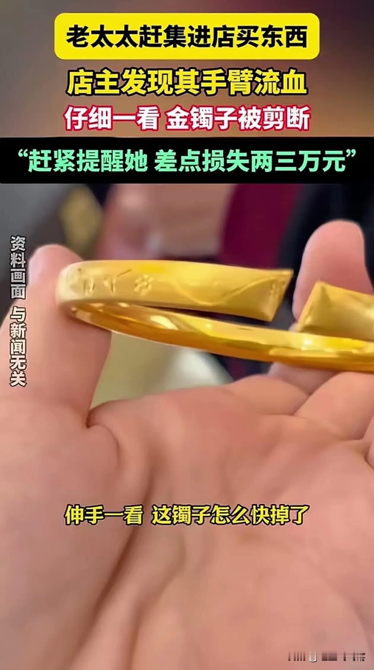 山东威海大娘遇“剪镯黑手”！流血竟没知觉，这事儿太吓人了“这咋跟做梦似的！”山