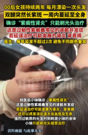 代价太大了！浙江杭州，一00后女孩热衷于染头发，基本上每个月都要染一次，已经持续
