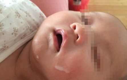 3个月宝宝睡着后没有醒, 医生说出原因, 很多宝妈有这个坏习惯