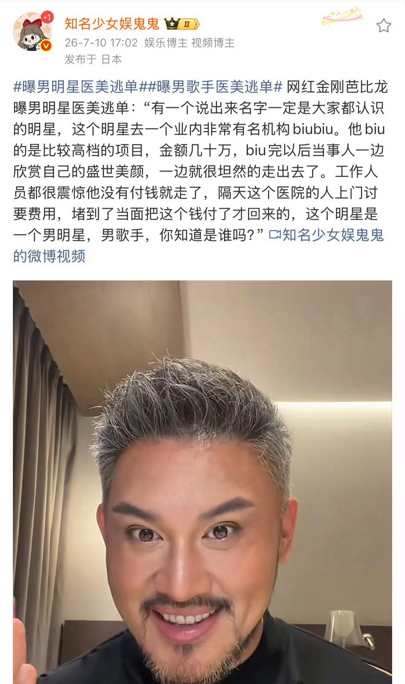 曝知名男歌手医美逃单首先排除薛之谦