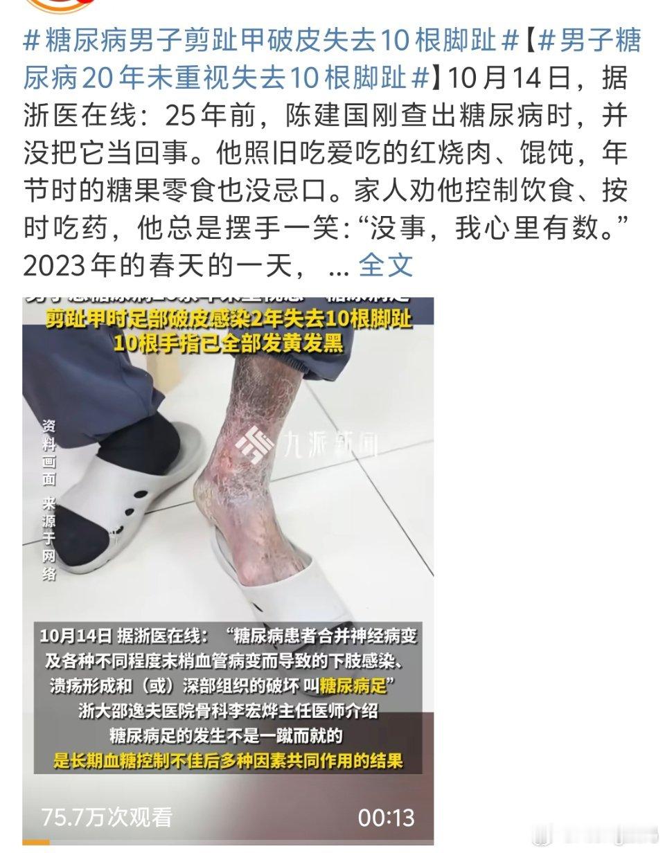 糖尿病男子剪趾甲破皮失去10根脚趾糖尿病越到晚期真的越可怕没
