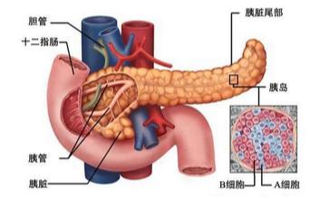 记住这几点，早诊早治胰腺癌记住这几点，早诊早治胰腺癌胰腺癌常被称为“癌中之王