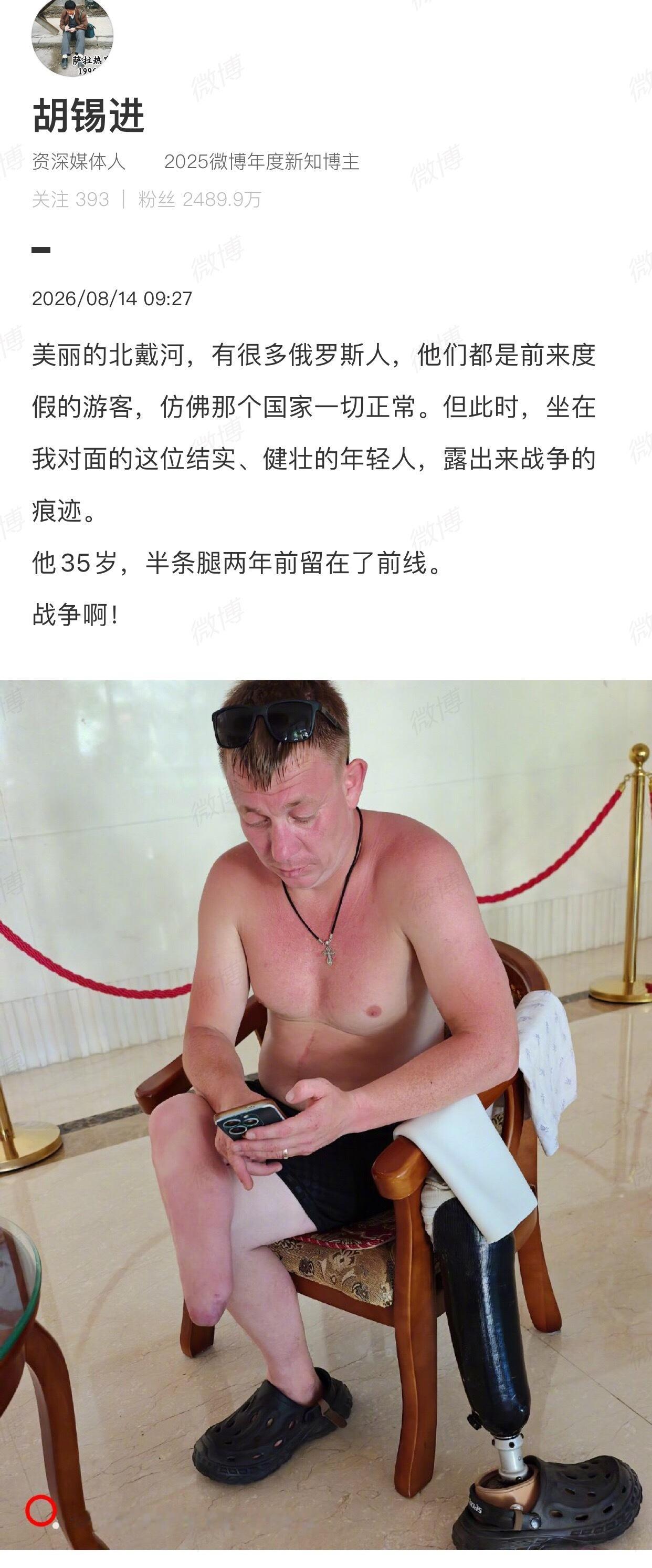 更正为：他35岁，半条腿两年前留在了乌克兰。