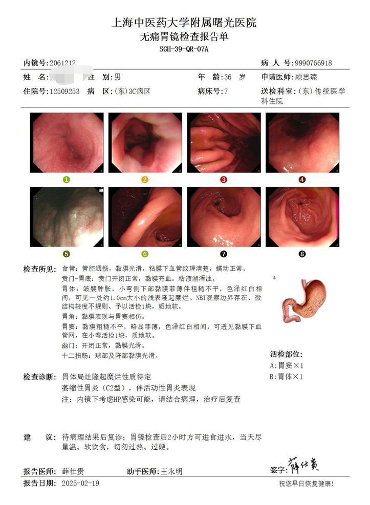 幽门螺旋杆菌感染很“隐匿”，查胃镜很重要。 幽门螺旋杆菌感染，很多人不...