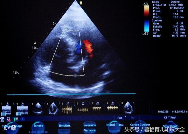 广东42岁二胎孕妇剖腹产6胞胎, 看着孩子们性别, 医生们都惊讶了