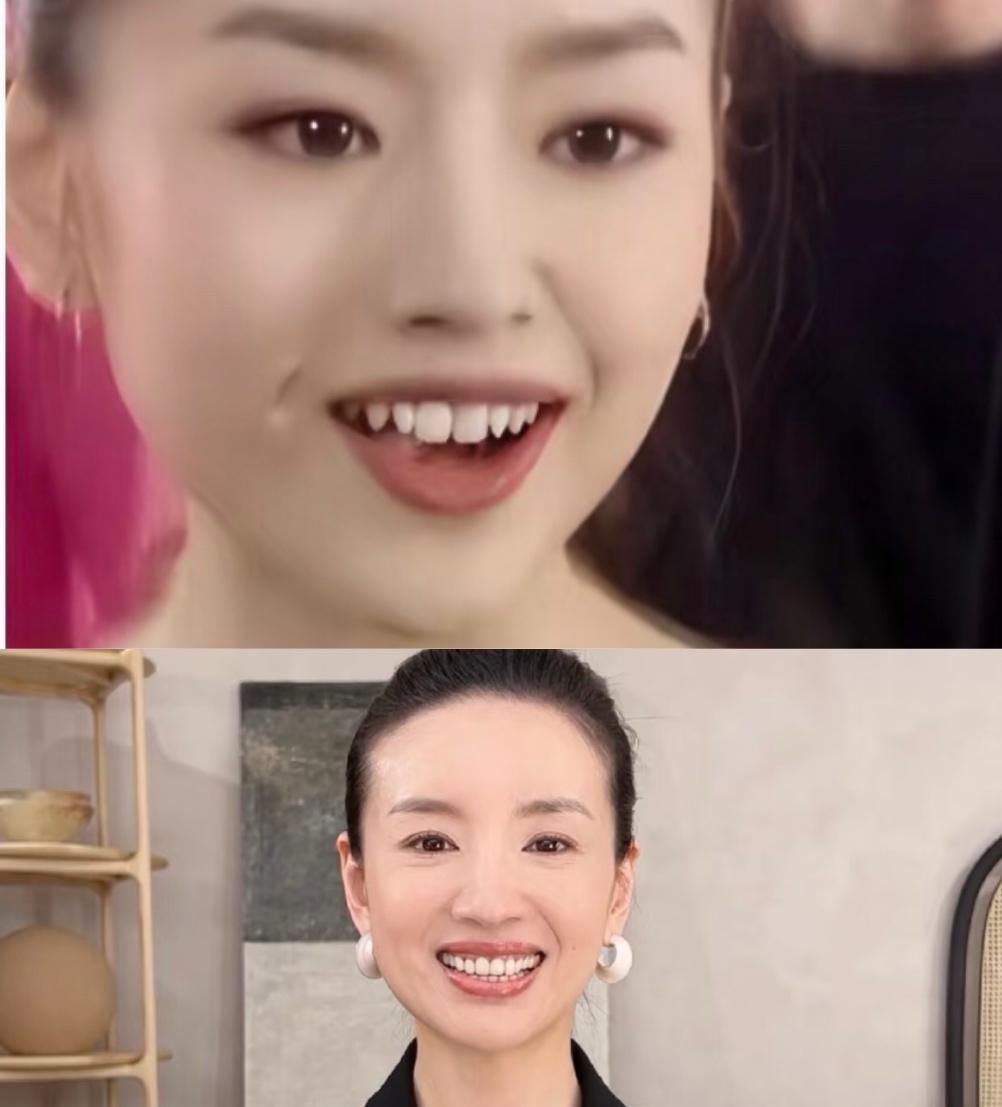董洁对她的牙齿做了什么，以前的牙挺灵性呀，尖尖的牙像小猫咪后来是贴片了吧整齐