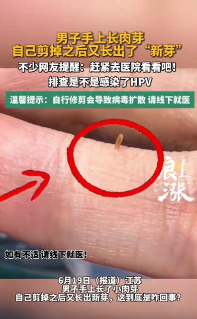 悲剧还是发生了！江苏南京，一男子手背上莫名冒出个小米粒大的肉色小疙瘩，不痛不痒但