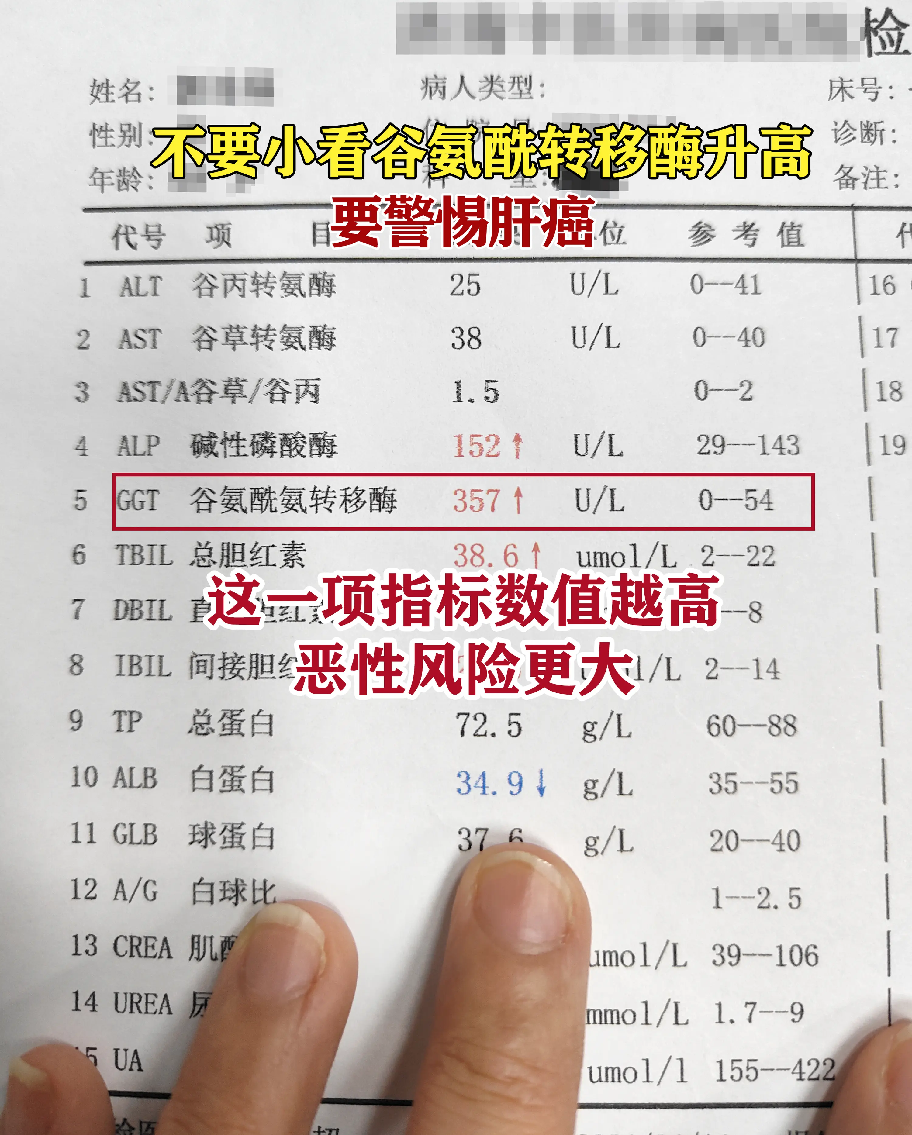 你知道吗？肝功能报告里常被忽略的谷氨酰转移酶，突然升高可能暗藏肝癌风险...