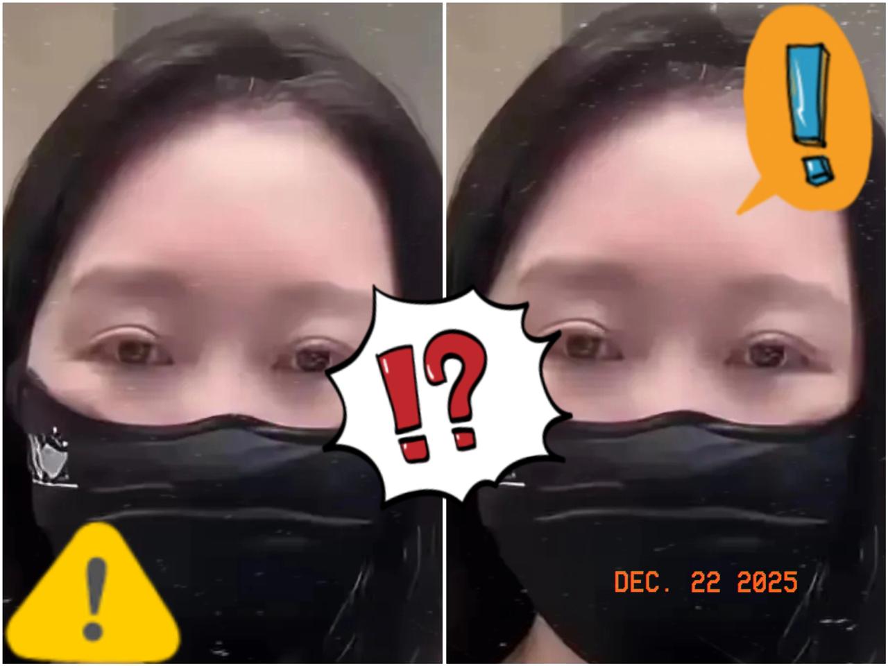 终于有人敢动真格的了，这建议提得太解气！​以后狗咬人主人直接进去踩缝纫机，这才