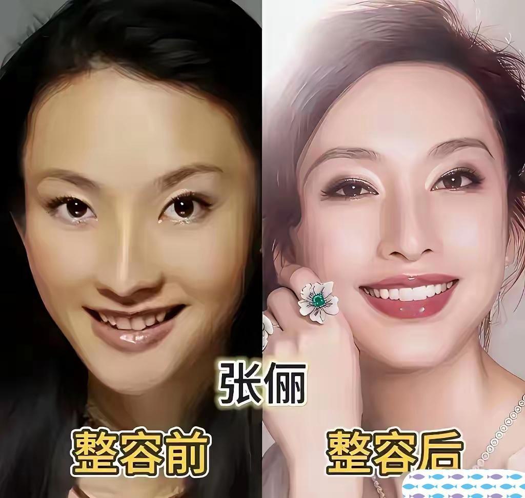 颜值审美不断变化，医美渐渐走入大众视野。不少女明星适度调整容貌，巧妙优化五官轮廓
