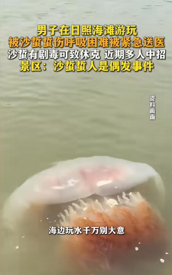 “太吓人了！”8月10日报道，山东日照，一男子在海滩游玩时，双腿不小心被沙蜇蜇伤
