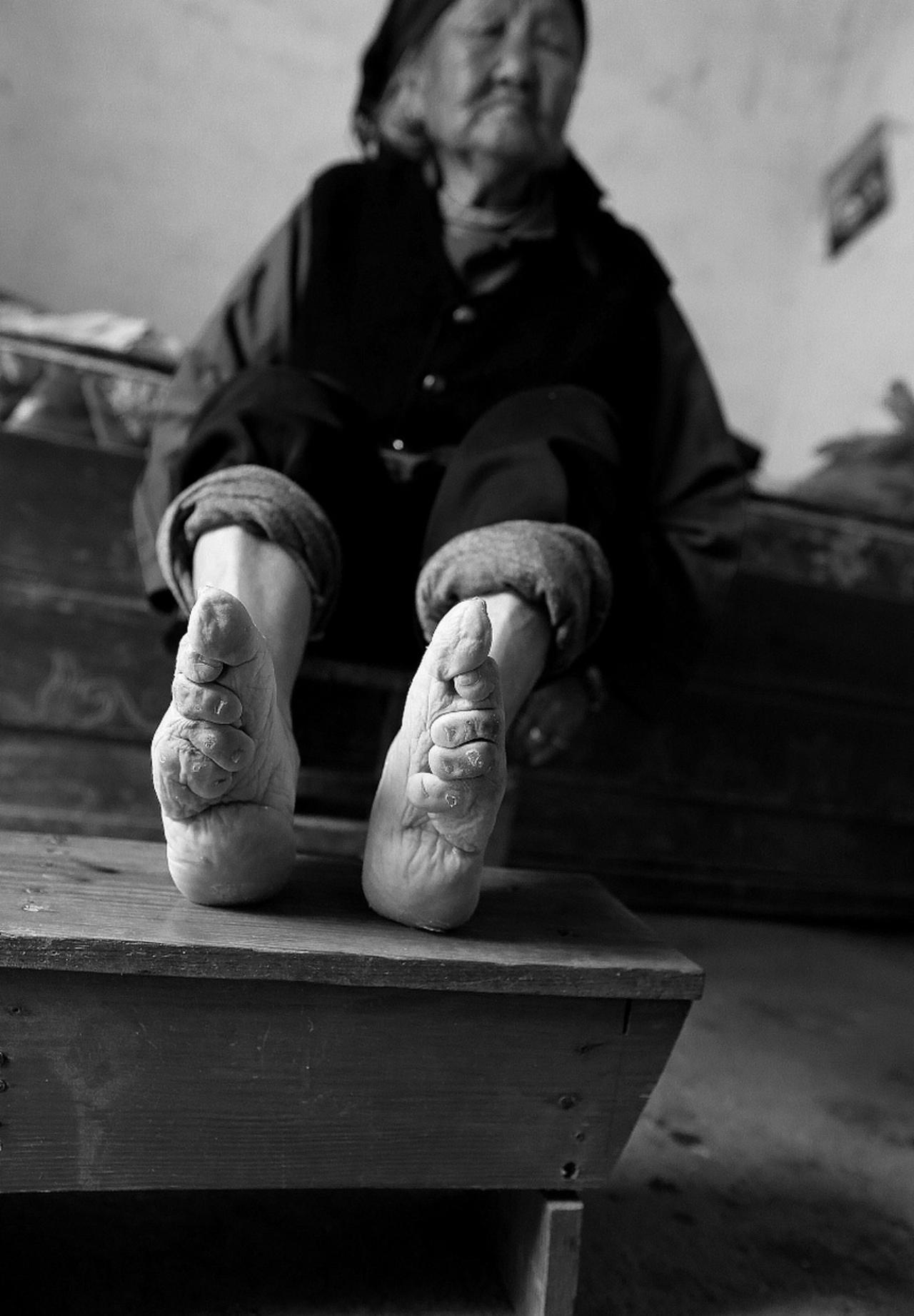 哎我去！太吓人了，到底是谁觉得裹脚好看啊！还起了歪名“三寸金莲”！这哪里好看了？