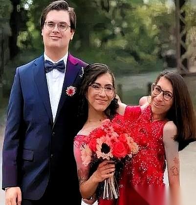 姐姐结婚了，那连体的妹妹怎么办？我知道，所有人脑子里第一个冒出来的，都是那个最