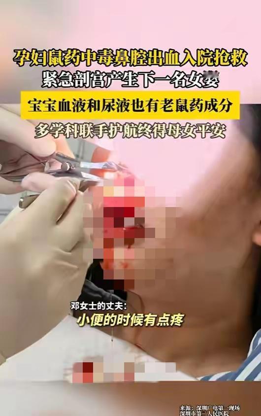 一个孕35周的孕妇会突然流鼻血，这可不是小事，老公赶紧送妻子去医院救治，想不到的