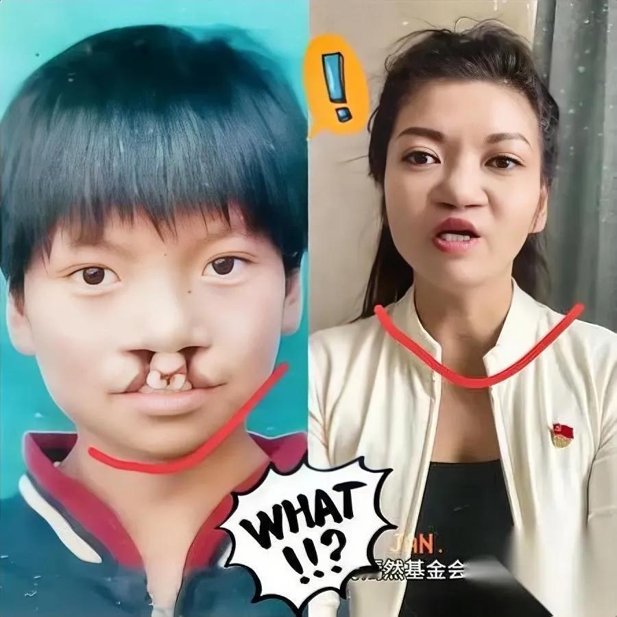 咱发现没？唇腭裂患者少有人发声直到抖音女生撕开伤疤直播我才懂这份支持有多