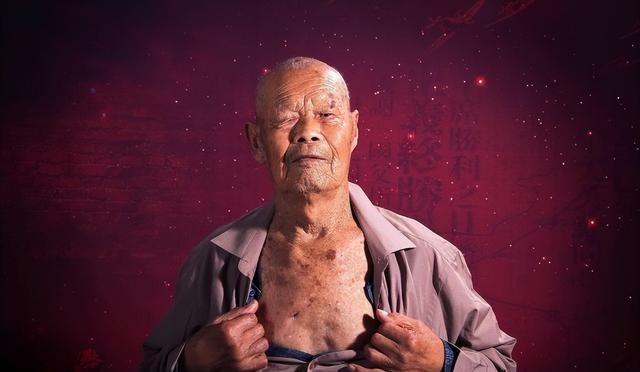 1956年，35岁农民，咳嗽10年，拒绝就医。一天，他突然用力咳嗽，“哇”的一声