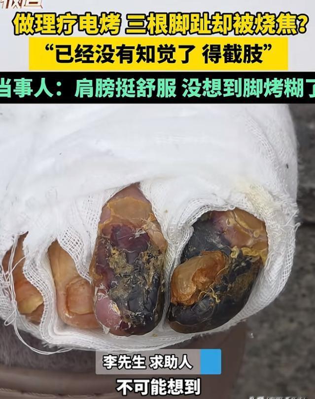 河南郑州，54岁男子患有糖尿病，来到朋友家做电烤。谁知，在烤脚的时候，接了一个电