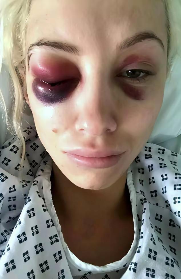 不是，这是怎么肿成这样的[捂脸哭]