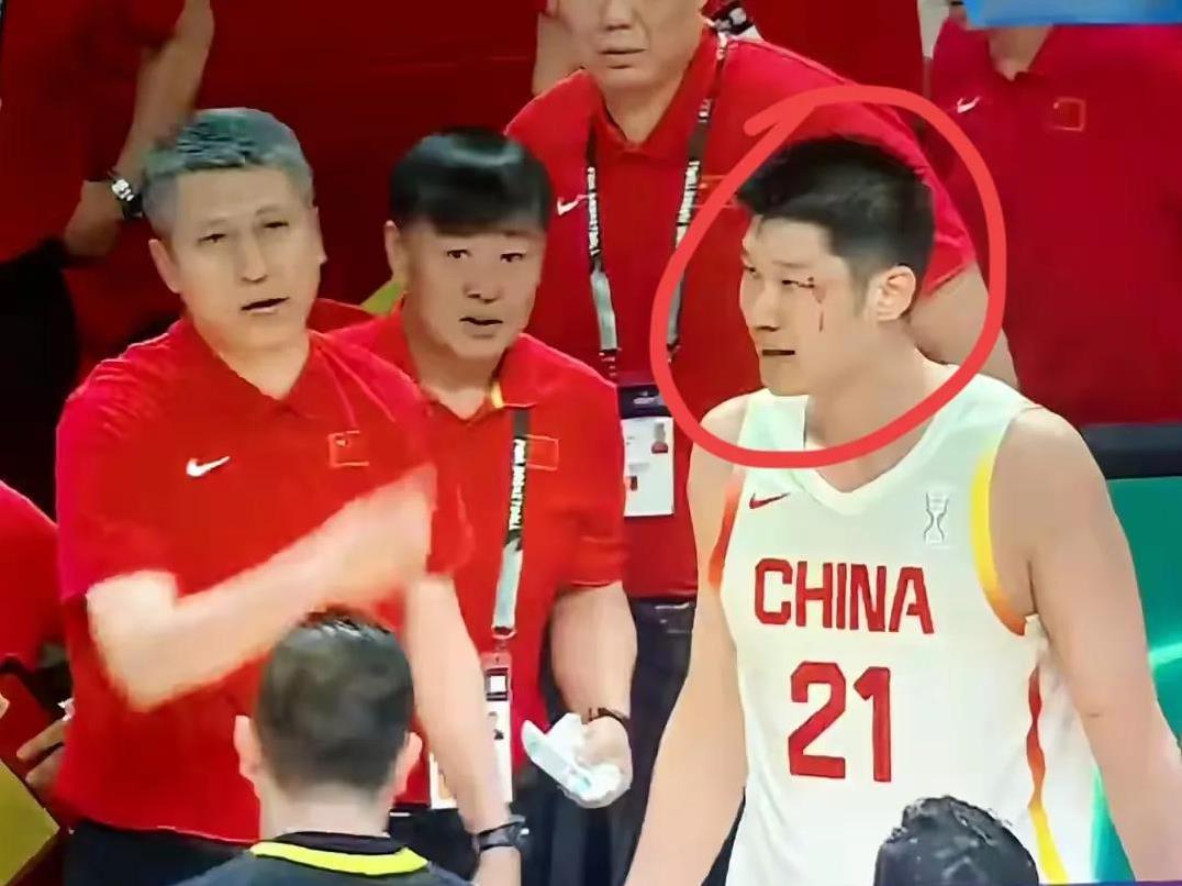 心疼胡金秋！胡金秋左眼角挂彩，赛后面对记者采访时，他说:“这没事，都是小事，对