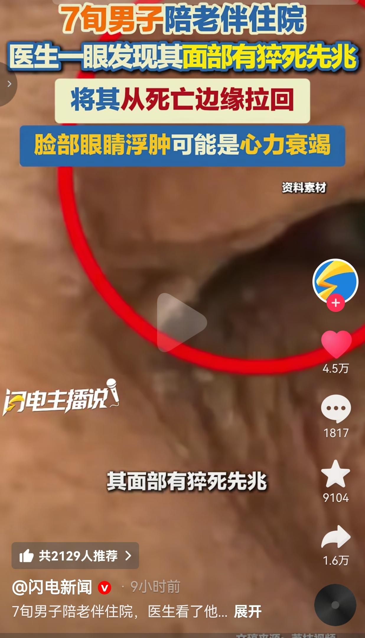 真的是后背发凉！医生就看了一眼陪床大爷的脸，直接把他从鬼门关拽了回来！江苏南