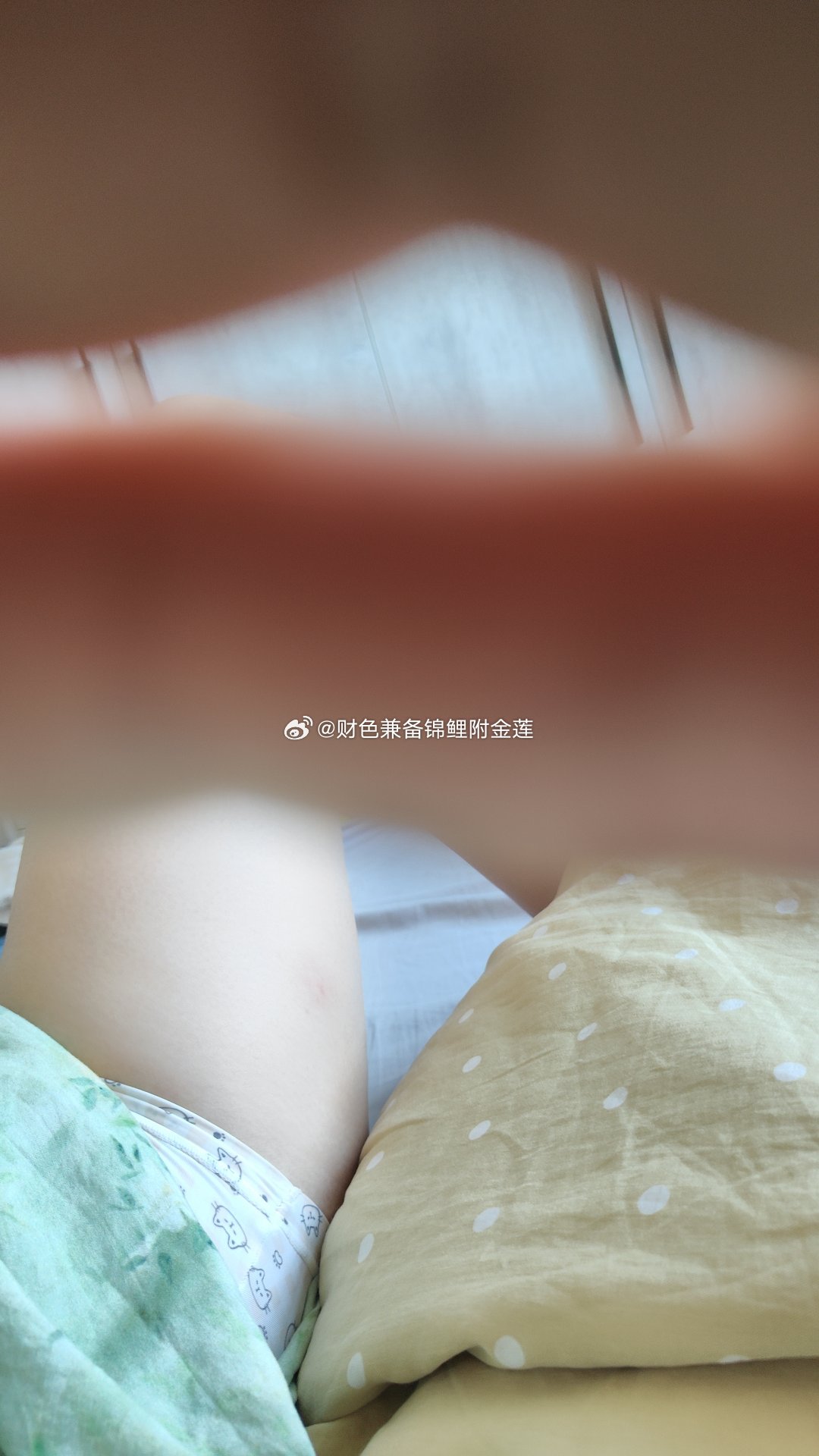 穿五分裤还让蚊子给叮个包它从裤腿飞进去无孔不入啊这