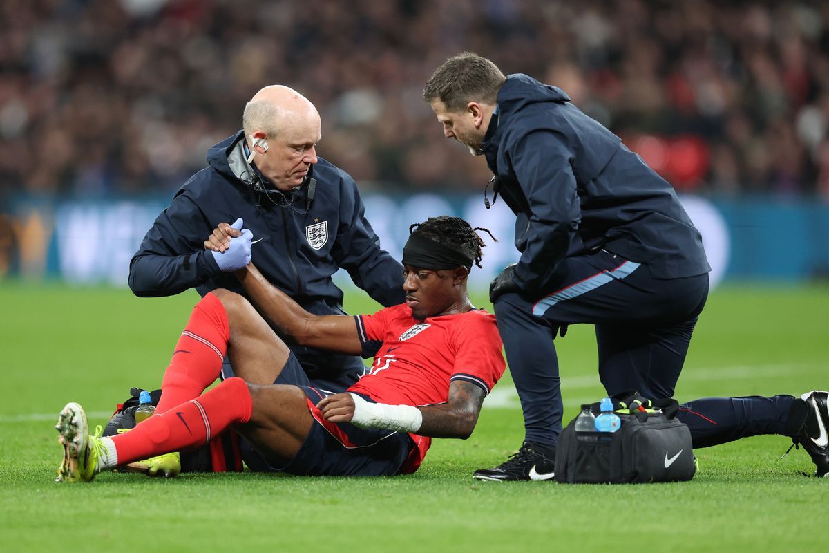 阿尔特塔赛前更新球队伤情：马杜埃凯的伤势没有最初担心的那么严重，他可能几天内就能