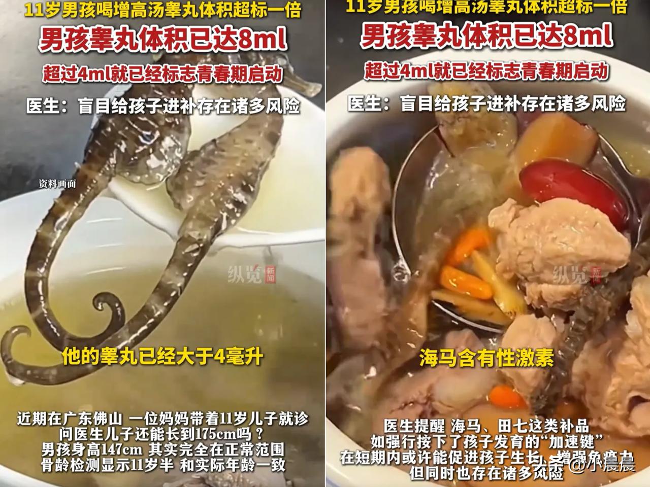 担心的事情还是发生了！广东佛山一位妈妈怕11岁儿子长不到175，天天熬