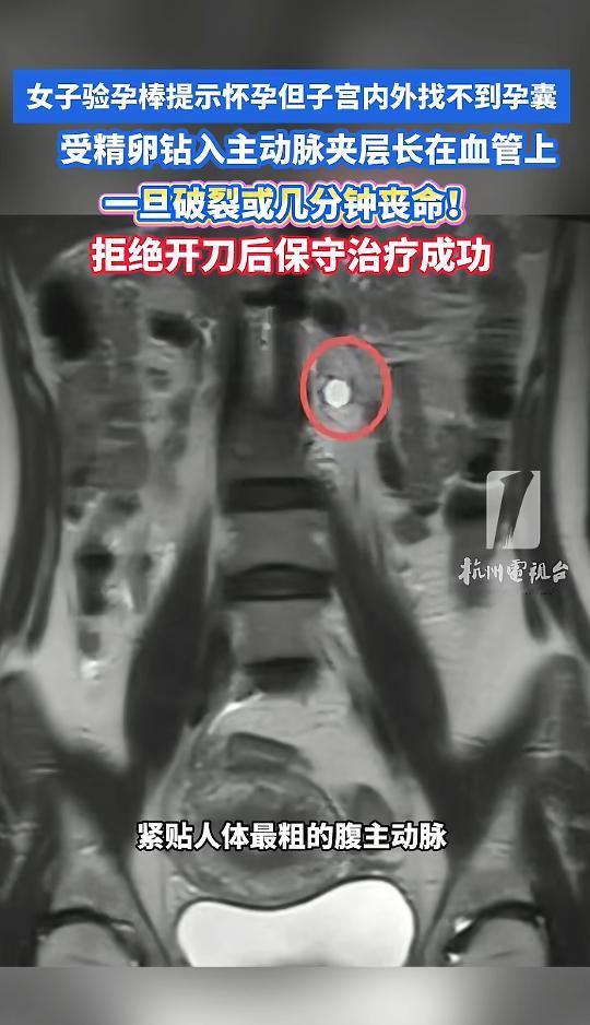 5月6日，深圳第三人民医院曝出一桩罕见病例，30多岁的王女士怎么也想不到，自己测