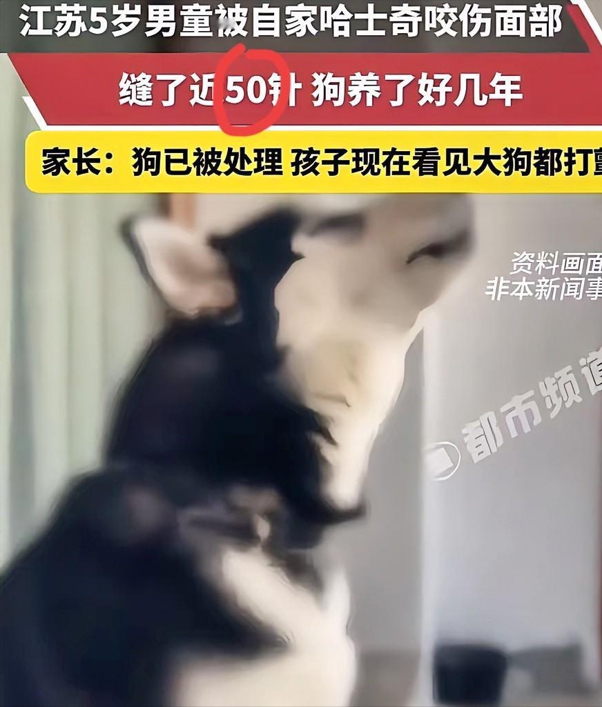 “这下养狗的都被干沉默了！”5月2日报道，江苏，5岁男童被自家养了5年的哈士奇咬