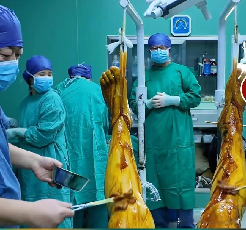 天哪！第一次看到，这么恐怖的画面！知道的，是骨科医生正在给做手术的患者，做腿部的