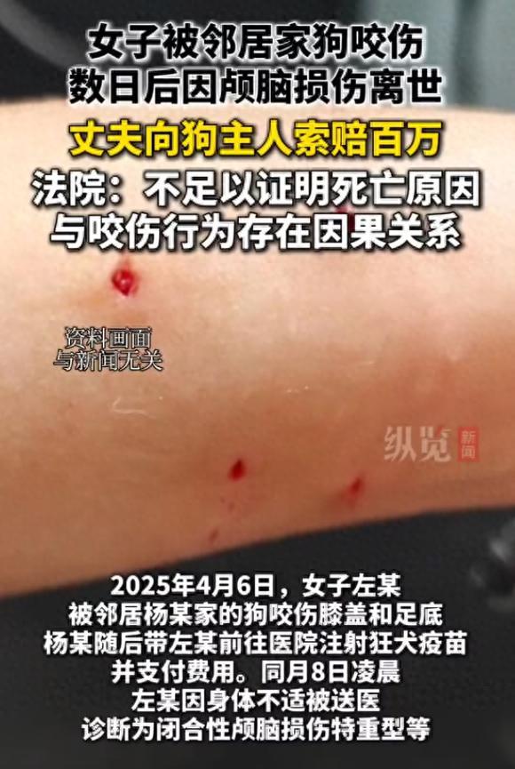 8月2日上观新闻报道，云南澜沧，一女子被邻居家小狗咬伤膝盖和脚，邻居赶紧带她去打