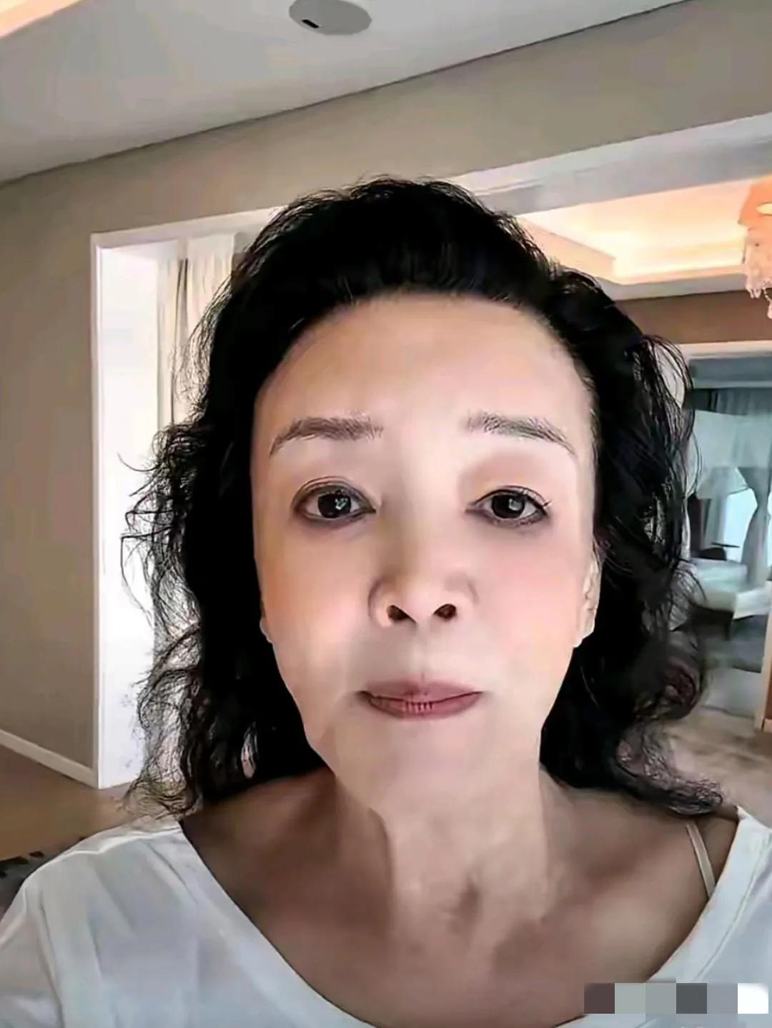 曾经漂亮的女强人张兰也肉眼可见的老了：头长脸长，额鼓嘴凸，脖子凹陷，眼角耷拉，看