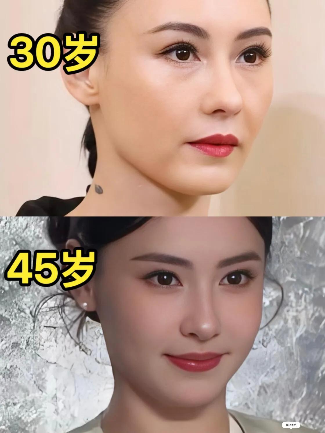 不是，微调真的不是医美界的“照妖镜”吗？以前只知道张柏芝是个大美女，但是现