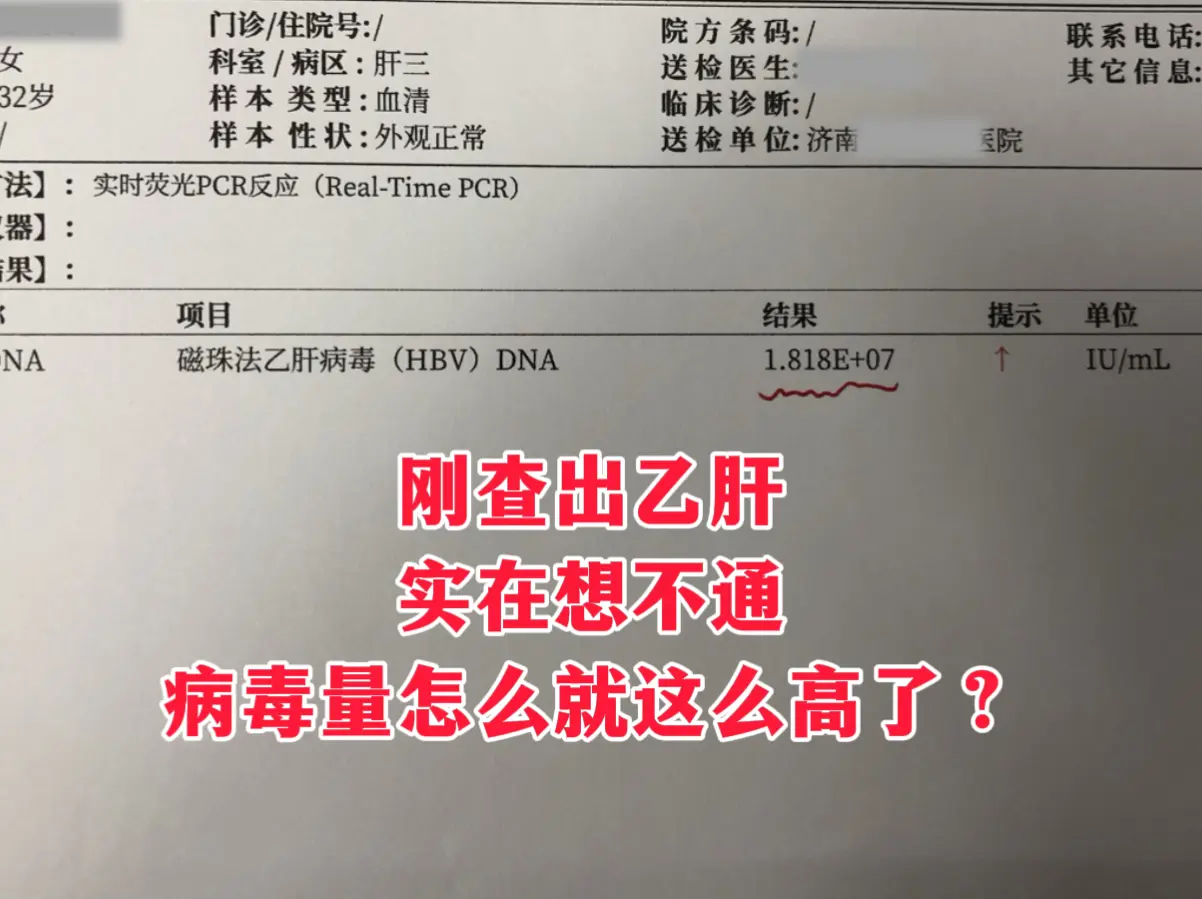 32岁的曹女士刚查出乙肝，病毒量是7次方，她问我这是多少病毒的时候自己...